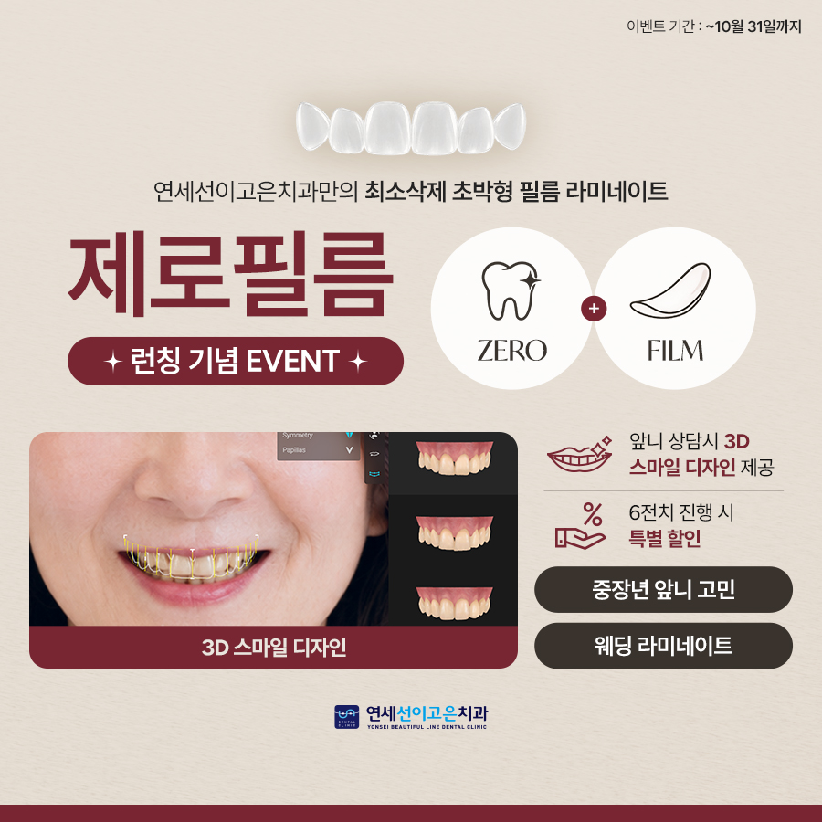 라미네이트