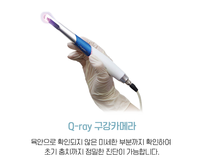 Q-ray 구강카메라 
